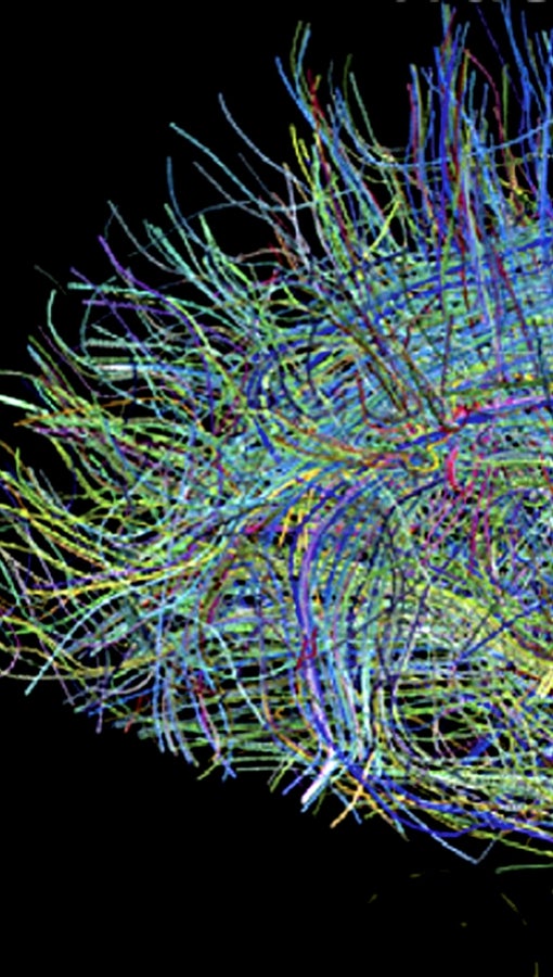 The human brain, represented in colorful fibers
