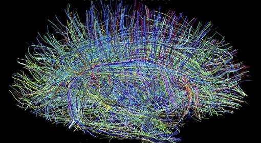 The human brain, represented in colorful fibers